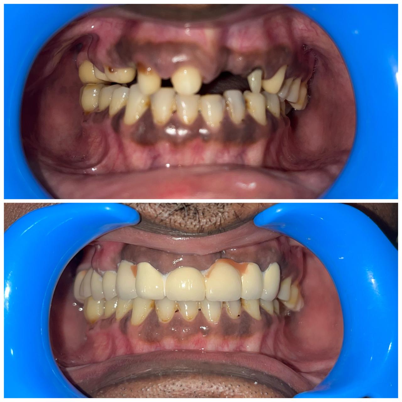 Patient Smile 12