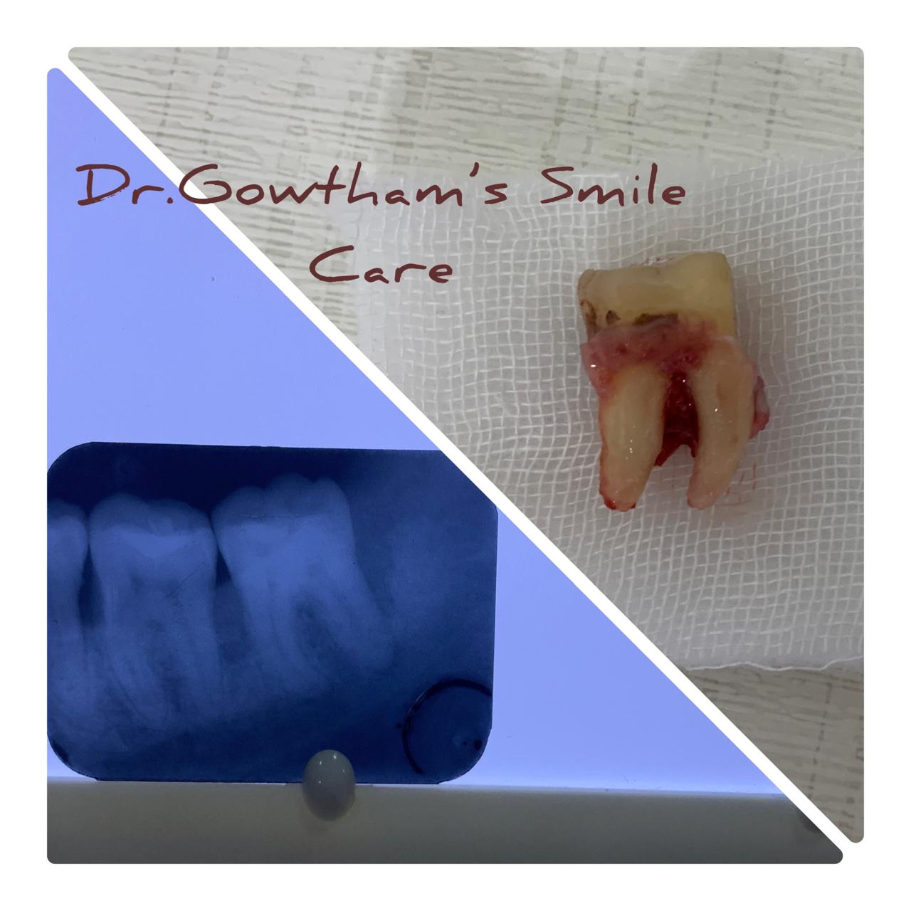 Patient Smile 15