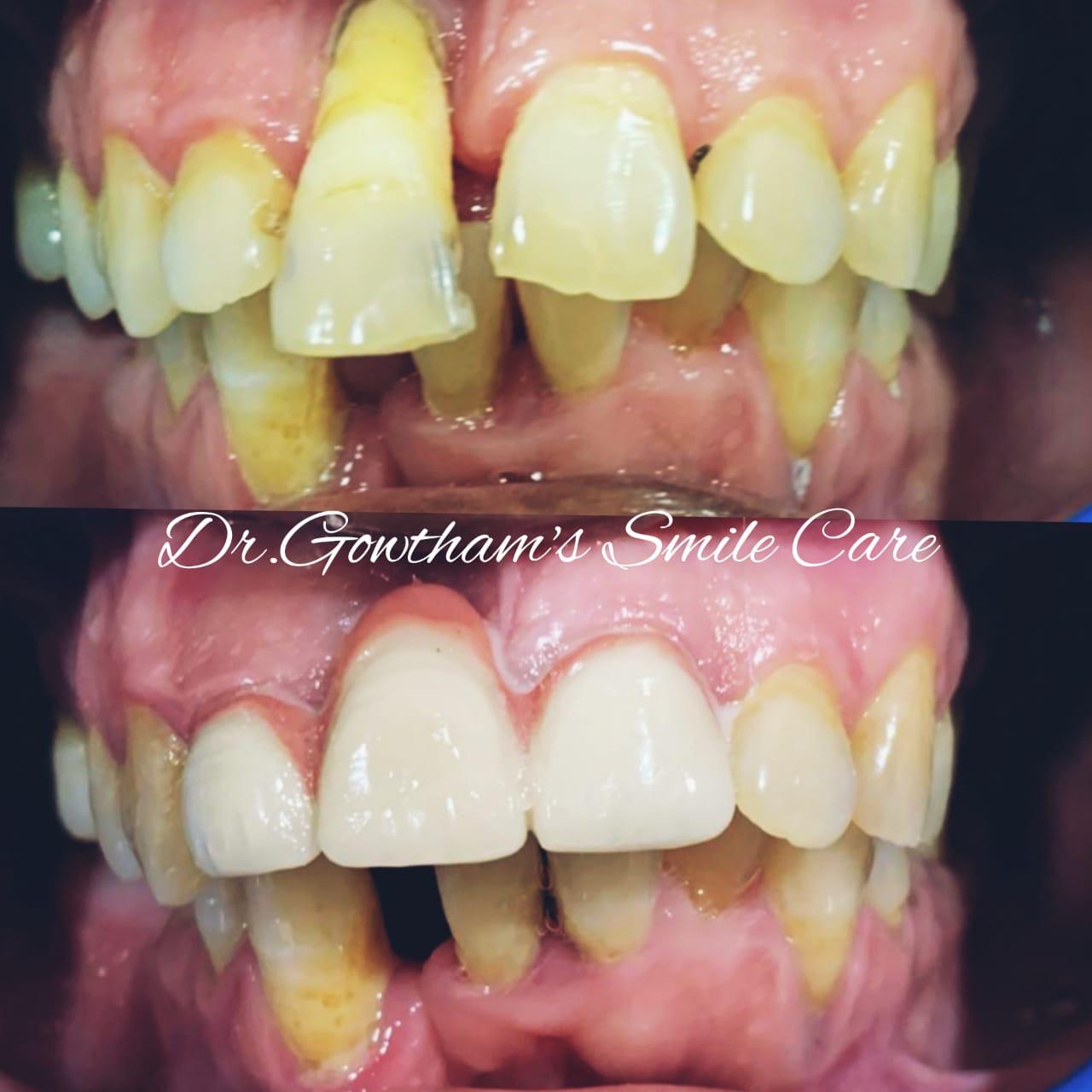 Patient Smile 10