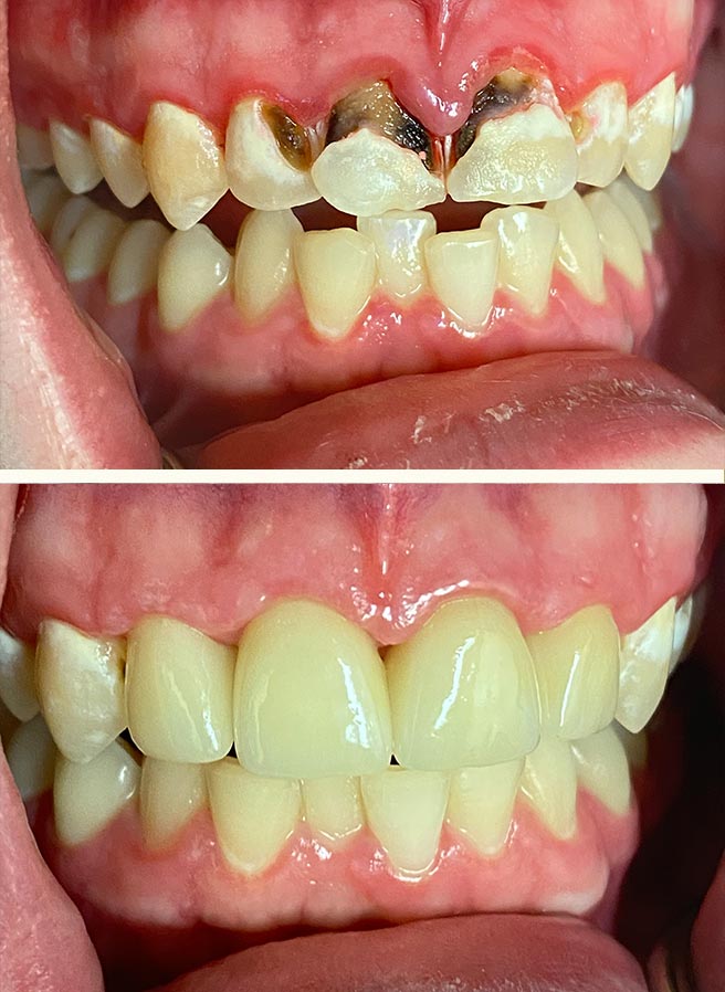 Patient Smile 8