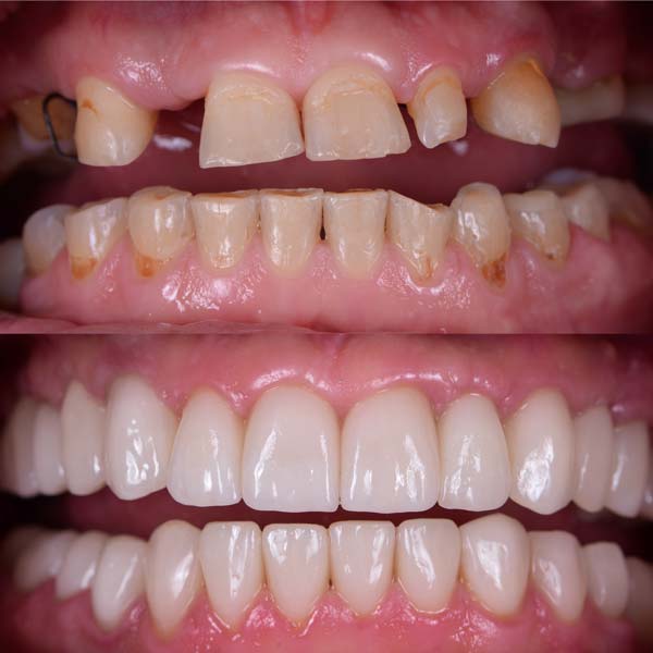 Patient Smile 6